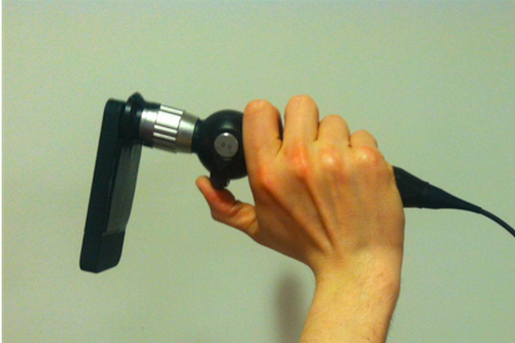Dr. Paskhover's make-shift attachment for his iPhone 4 case